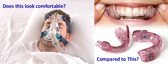 oral appliance compared to cpap mask